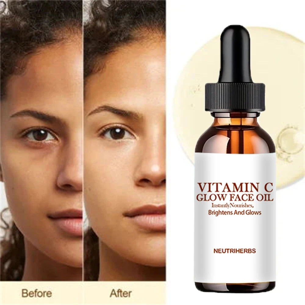 Vitamin C Radiant Oil - Plant Extracts for Balanced, Moisturized Skin