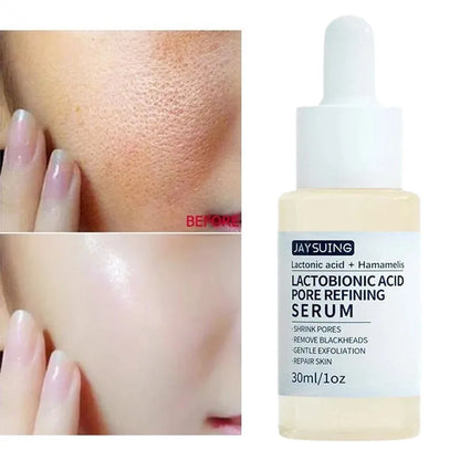 Pore Shrinking Face Serum - Tightening, Repairing & Whitening Skin Care